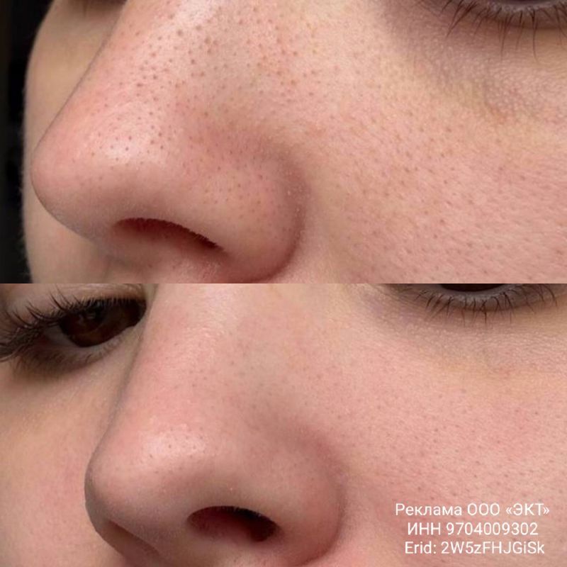 Энзимная пудра: секрет свежести кожи, о котором вы не знали