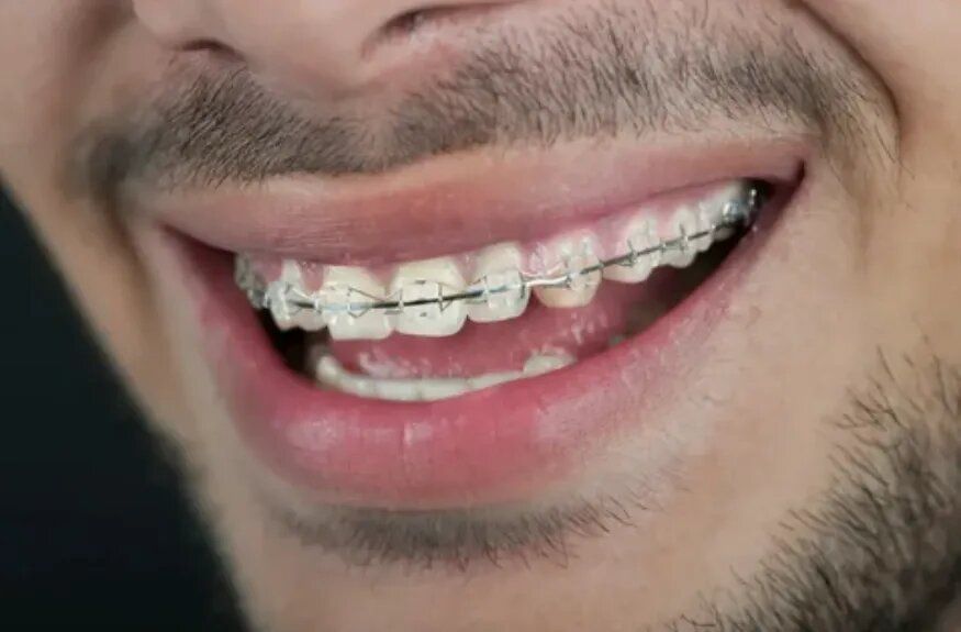 ������� � ������ � �����: ��������� �������� � ����������� ������