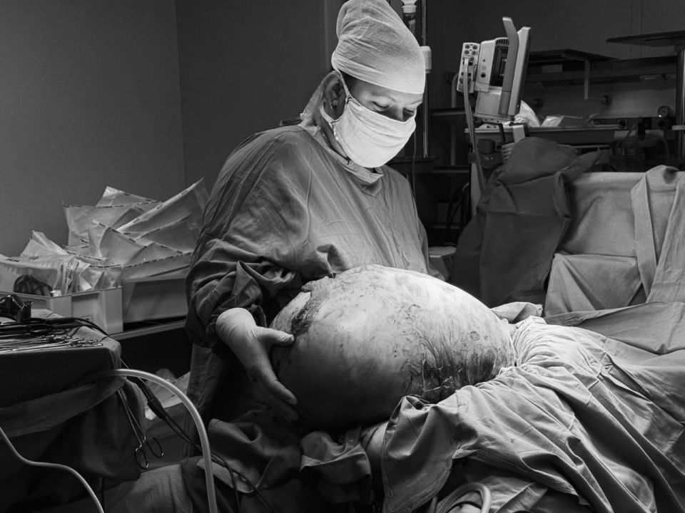 Игорь Трифонов: Врачи нашей Королёвской больницы провели уникальную операцию — удалили опухоль весом 20 килограммов и диаметром 50 сантиметров у 46-летней жительницы