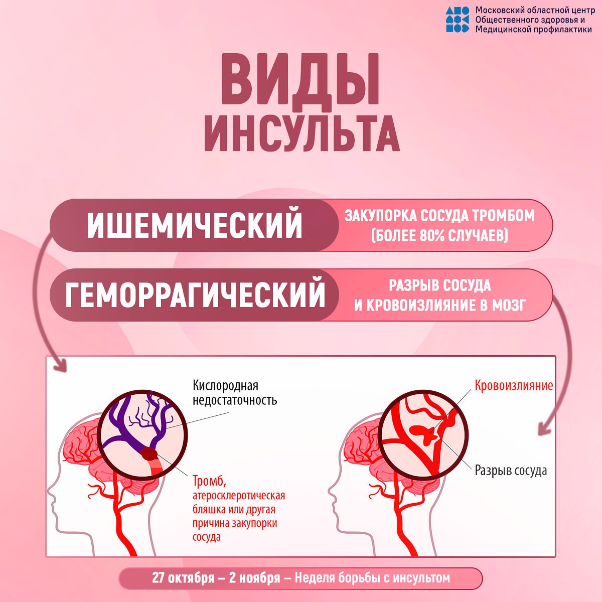 29 октября - Всемирный день борьбы с инсультом 29 октября - Всемирный день борьбы с инсультом
