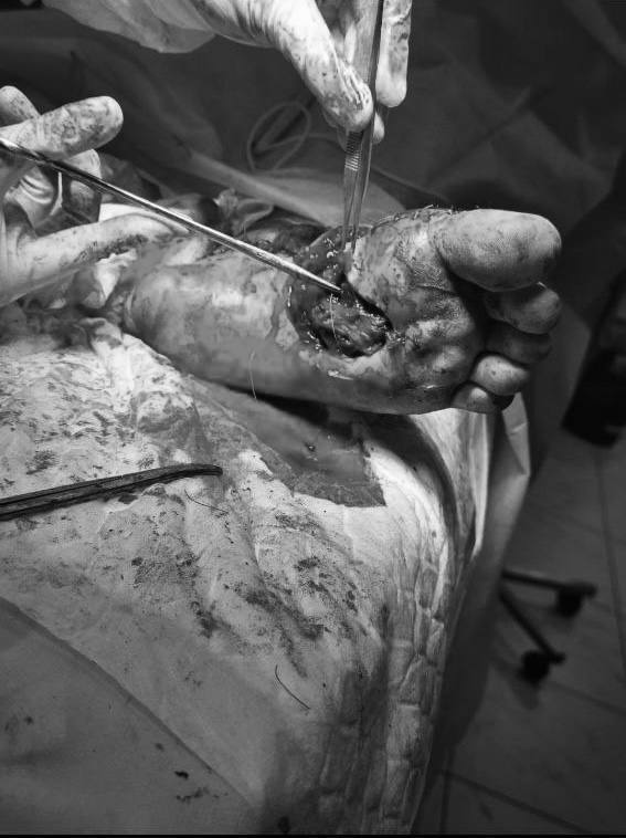 Подмосковье: врачи спасли ногу подростку после ДТП Подмосковье: врачи спасли ногу подростку после ДТП