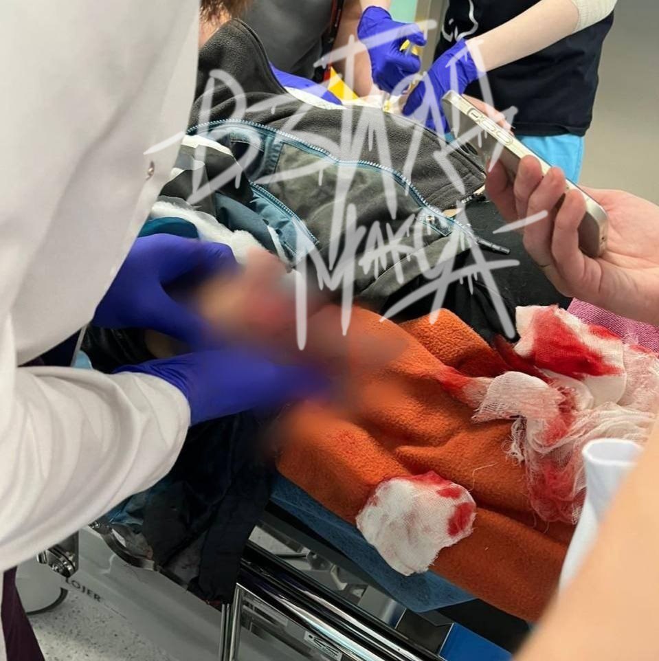 В подмосковном Красногорске вечером 11 ноября произошёл взрыв, в результате которого тяжело пострадал 9-летний мальчик