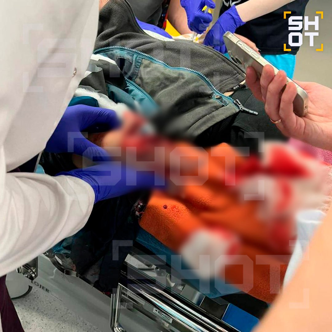 Ребёнку разворотило кисть, когда он потянулся за деньгами в подмосковном Красногорске Ребёнку разворотило кисть, когда он потянулся за деньгами в подмосковном Красногорске