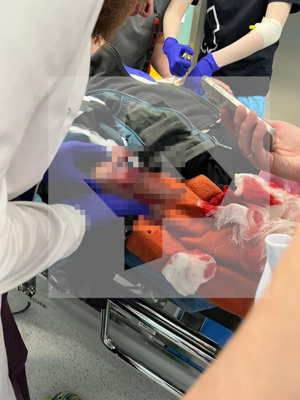 В соцсетях пишут, что ребенку повредило взрывом руку, когда он попытался поднять лежавшие на земле купюры у детской площадки в подмосковном Красногорске В соцсетях пишут, что ребенку повредило взрывом руку, когда он попытался поднять лежавшие на земле купюры у детской площадки в подмосковном Красногорске