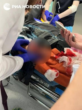 Осторожно, жесткие кадры!. Ребенок пострадал от взрыва, когда поднял деньги с земли в подмосковном Красногорске, рассказал РИА Новости очевидец Владимир Шарупич