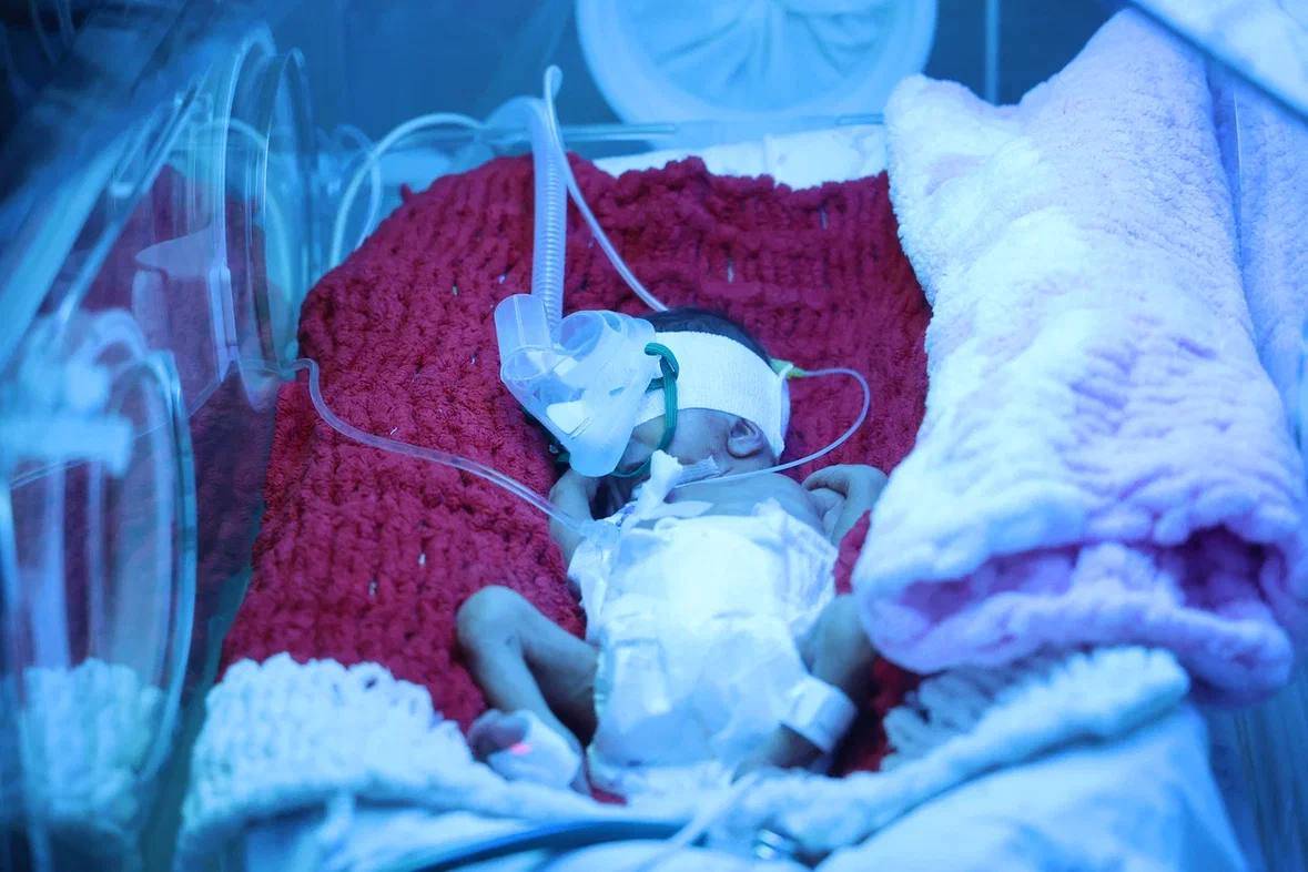 Сергей Юров: День недоношенного ребёнка Сергей Юров: День недоношенного ребёнка