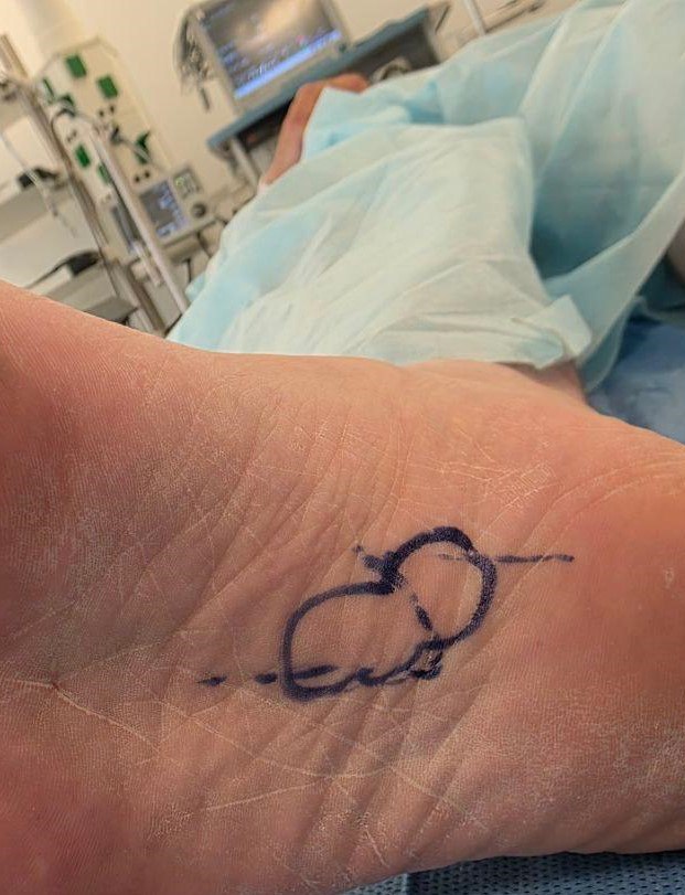 В больнице Долгопрудного прооперировали пациента с редким заболеванием В больнице Долгопрудного прооперировали пациента с редким заболеванием