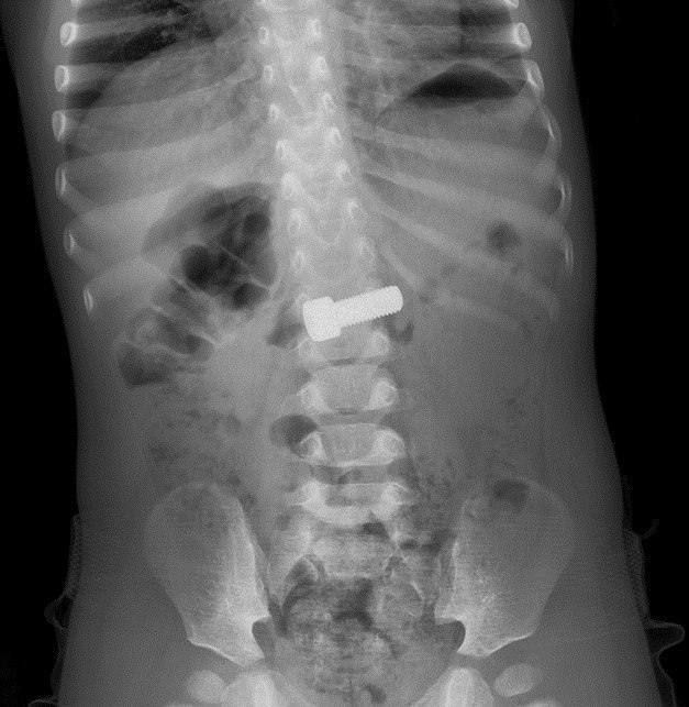 ����� �������� ���� �� ������� ���������� ������