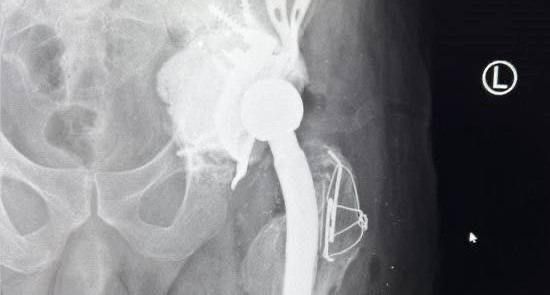 ������������ ����� ����� ������ ����� ������� �������� ����� ���������� �������