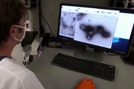 Оспа обезьян уже в России: кому и чем грозит новый вирус