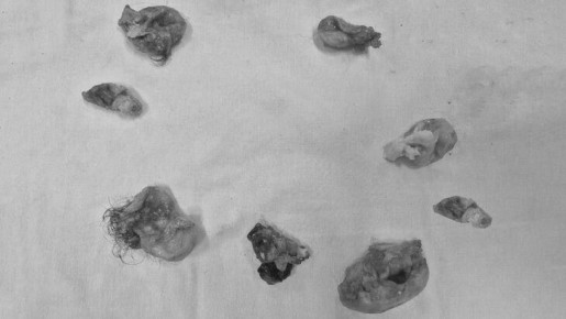 ����� ����������� ������� � ������� ������ ���� � �������� ������