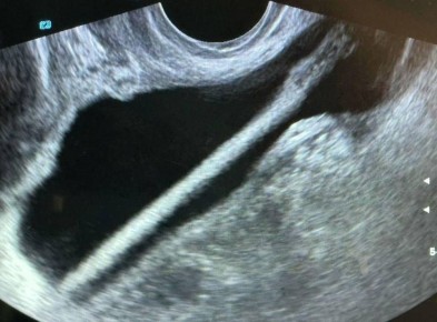 � ����������� ����� ������� �� �������� ������ ������� ������������� ��������