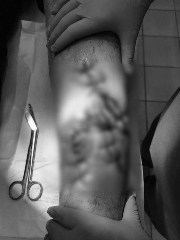 � ����������� ����� ������ ������� �� ��������� ����