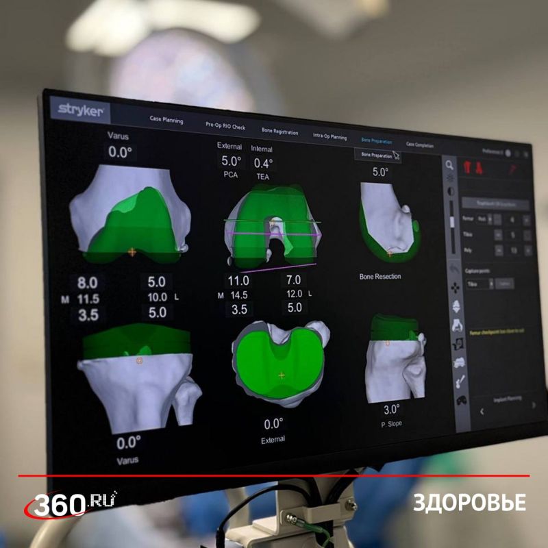 ������ �����-������ ��������� � �����������