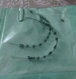 ���� �������� ��������? �������� ����� ��������� �������������� �������