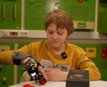 Десятилетнему мальчику, которому оторвало пальцы взрывчаткой в подмосковном Красногорске, установили протез