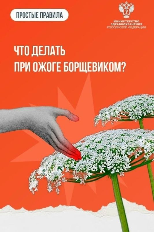 Что делать при ожоге борщевиком?