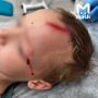 На внука Дарьи Донцовой напала собака у его дома в Подмосковье — огромный пёс набросился на ребёнка и стал кусать его за голову
