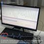 Новый плетизмограф для исследования периферического кровотока появился в Орехово-Зуевской больнице