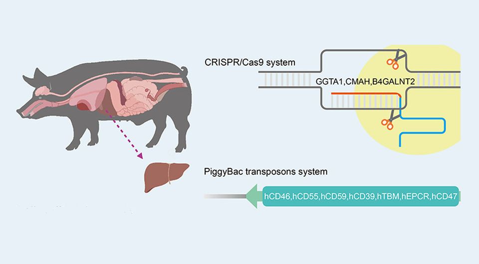 Свиная печень впервые пересажена пациенту с опухолью